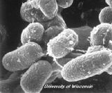 Pablo J. Pinedo, Claus D. Buergelt, G. Art Donovan, Pedro Melendez, Laurence Morel, Rongling Wu, Taimour Y. Langaee and D. Owen Rae,
Association between CARD15/NOD2 gene polymorphisms and paratuberculosis infection in cattle
Veterinary Microbiology, Article in Press, Corrected Proof, doi:10.1016/j.vetmic.2008.09.052